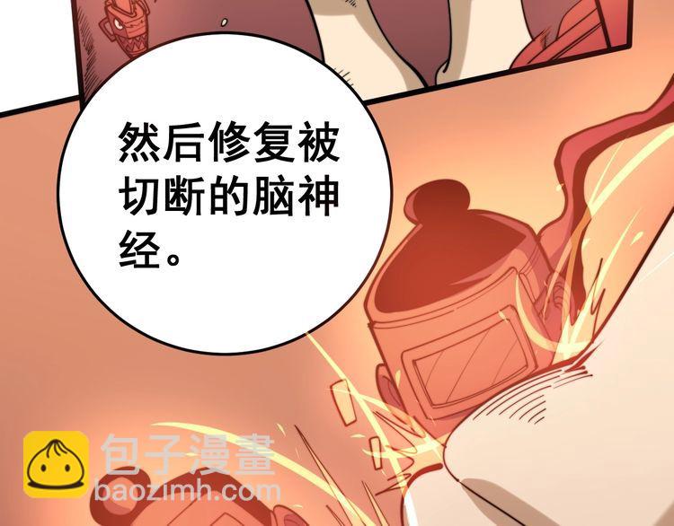 第147话 切神经81