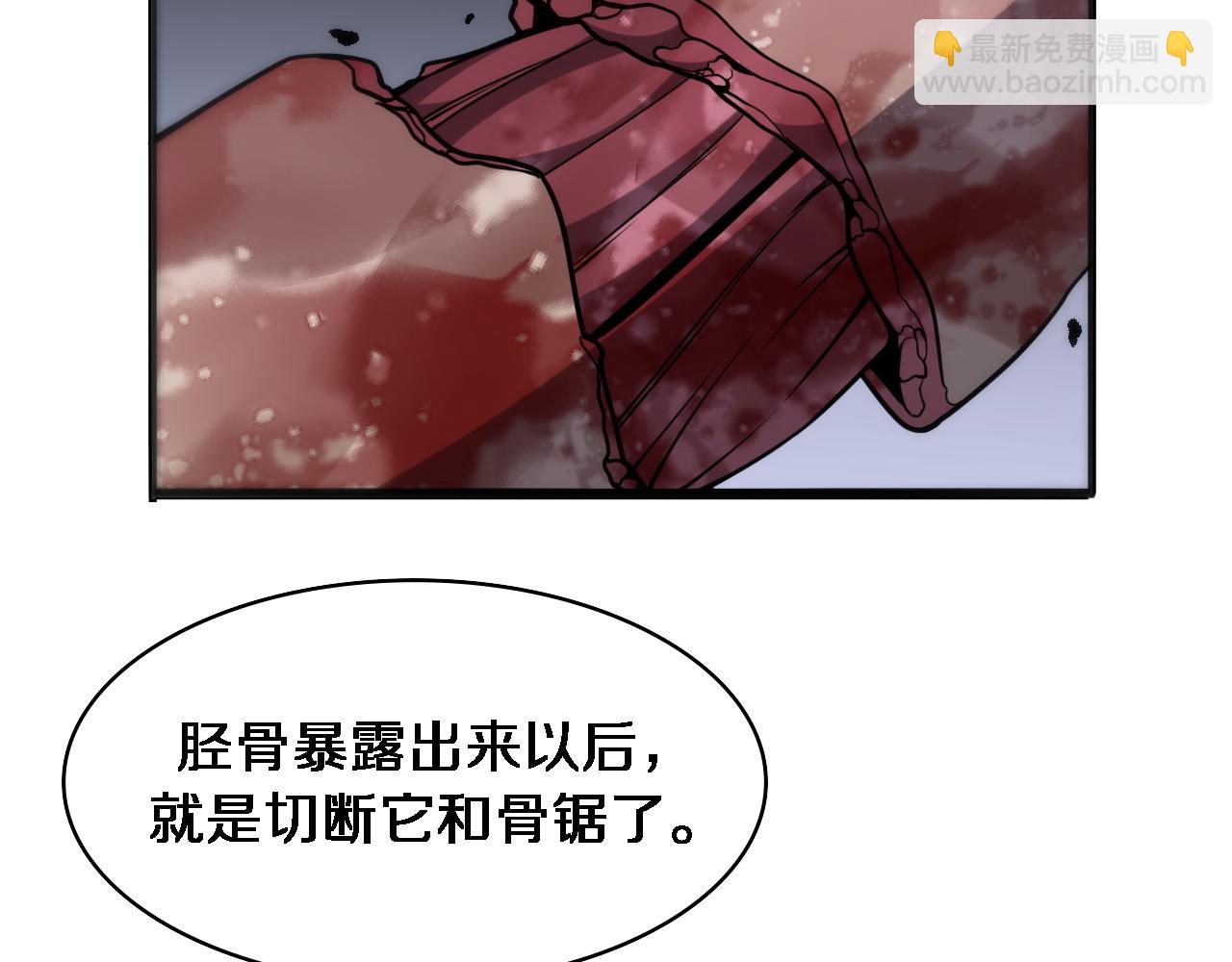 第95话 第一次做截肢手术84