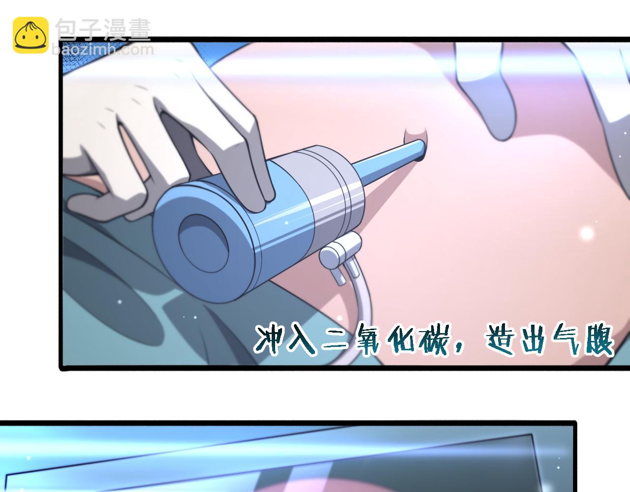 第165话 胆囊手术68