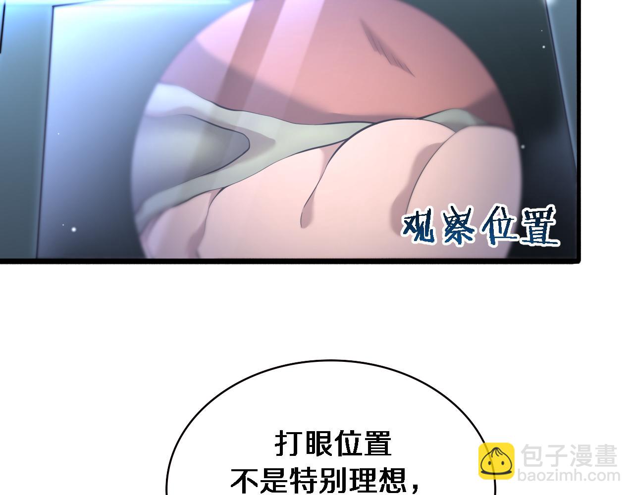第165话 胆囊手术69