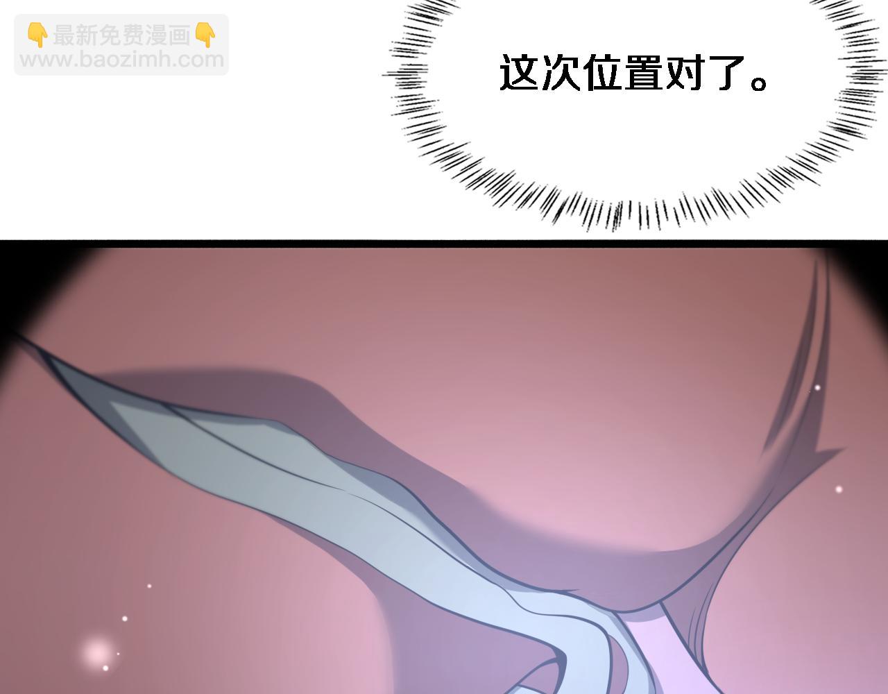 第165话 胆囊手术74