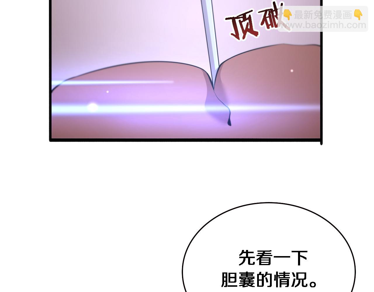第165话 胆囊手术78