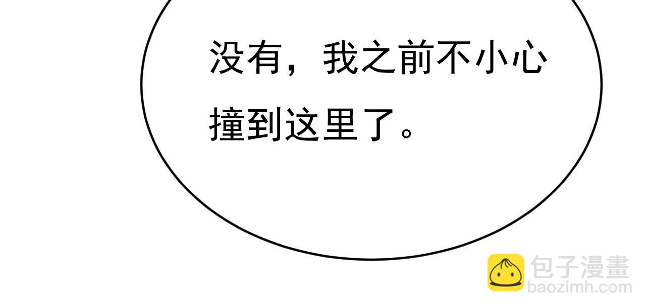 第647话 我捏得这么重？28