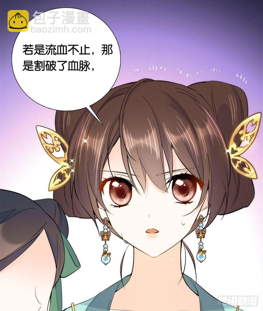 第71话 公主殿下受伤了25