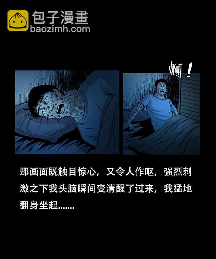 怪病30