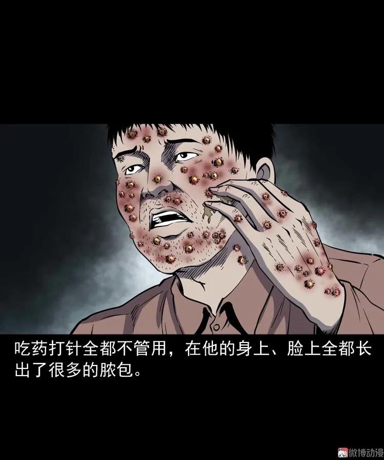 误诊69