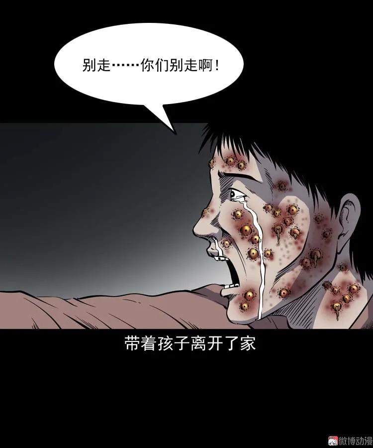 误诊71