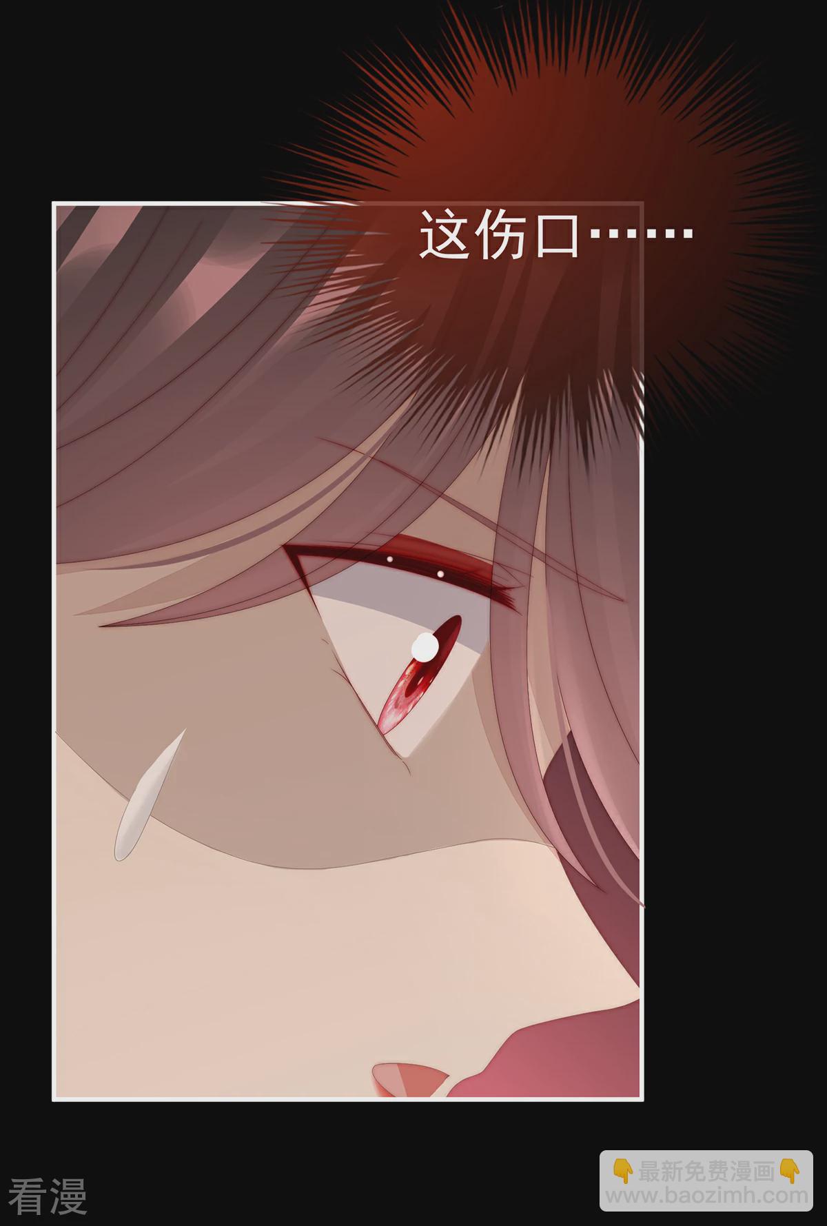 第63话 小猪仔要死了？！22