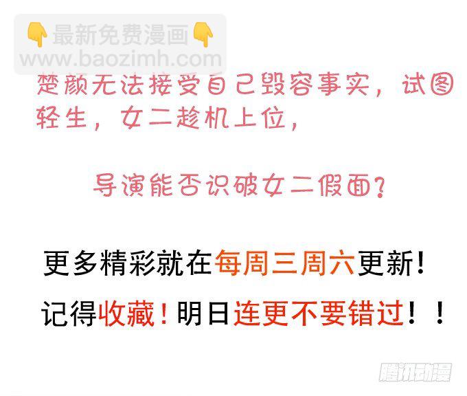 女主毁容？！32