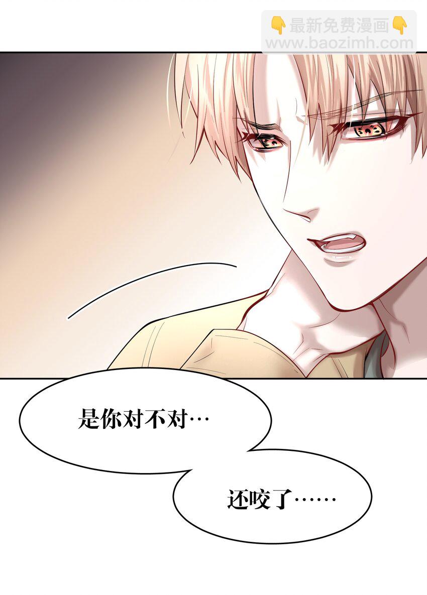 第33章 疯狗咬了一口25