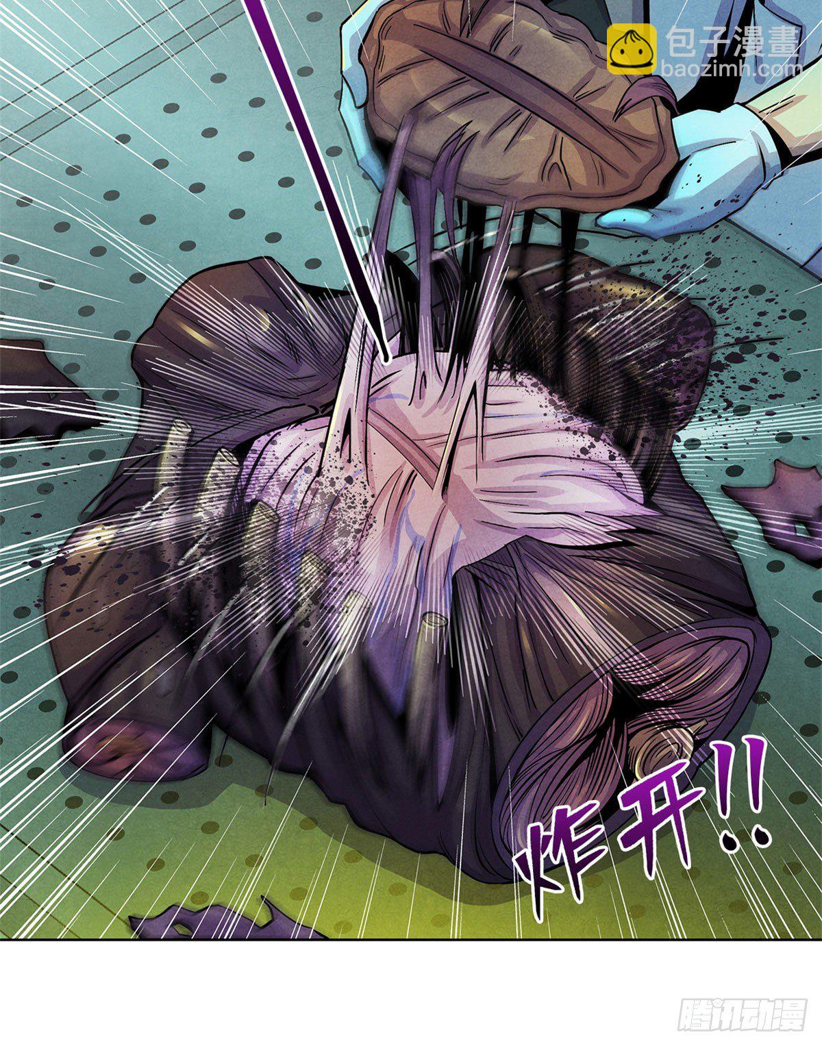 21 解刨还是分尸47