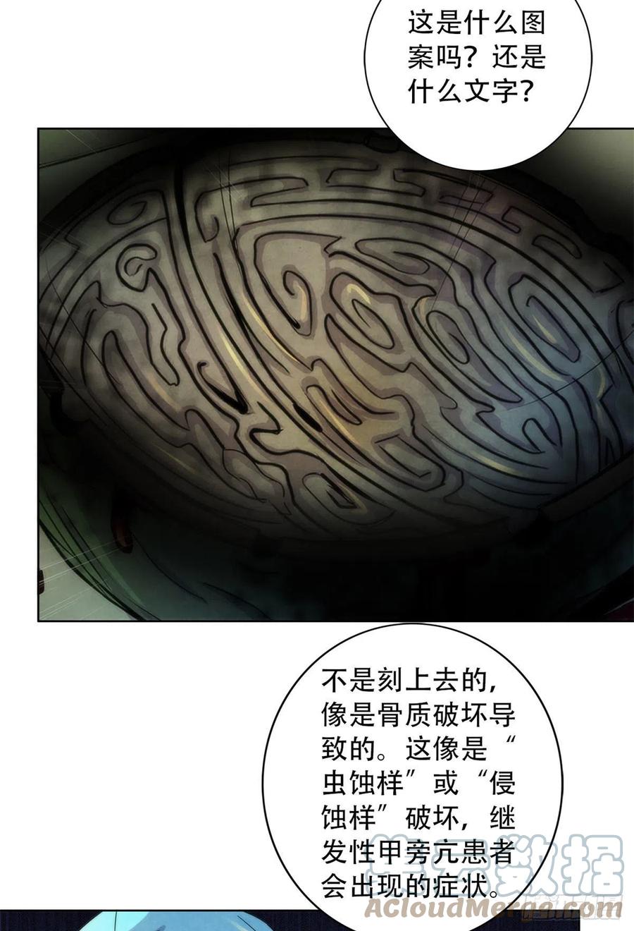 92 颅骨顶盖32