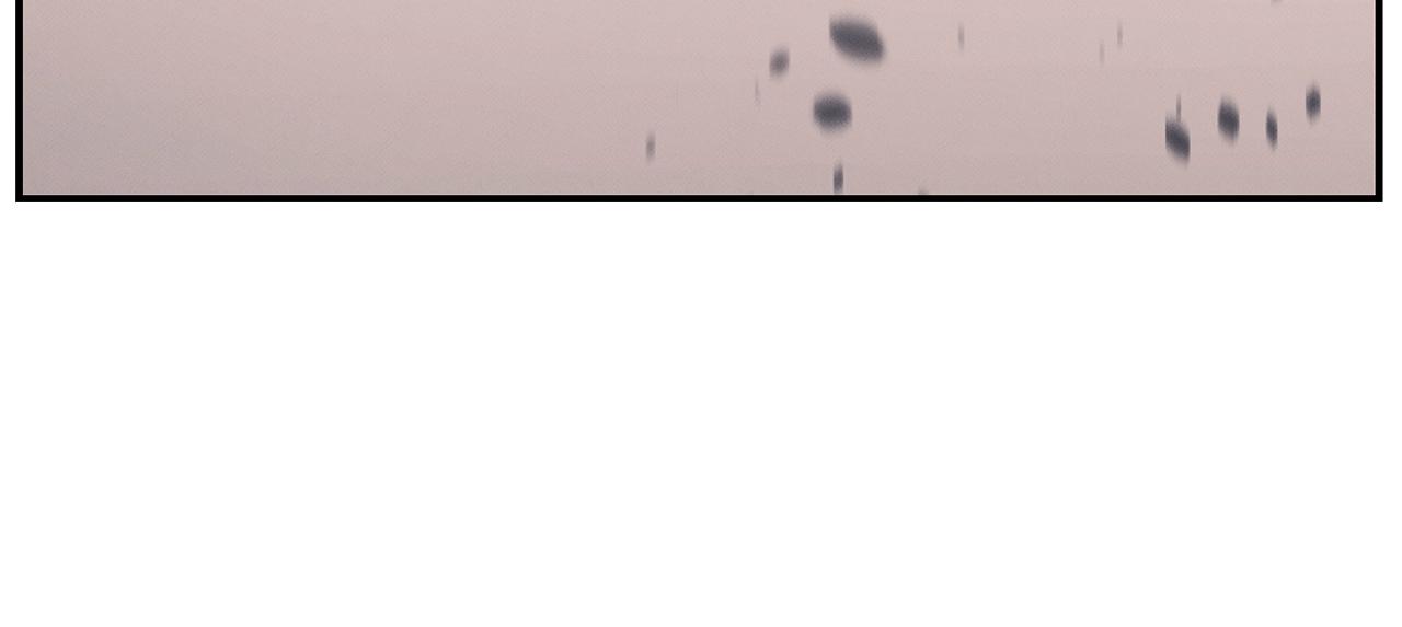 第121话 手术开始114