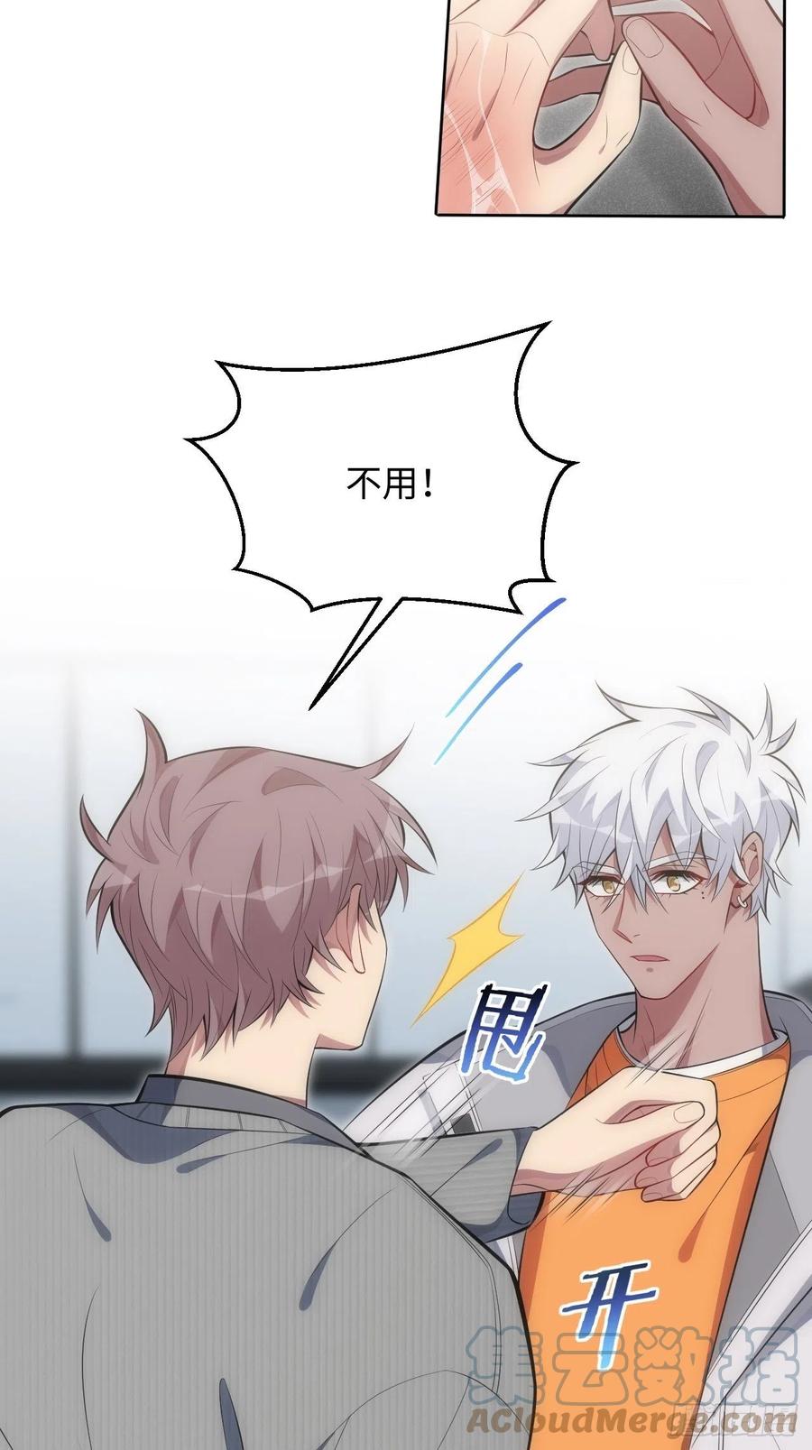 54.烫伤10