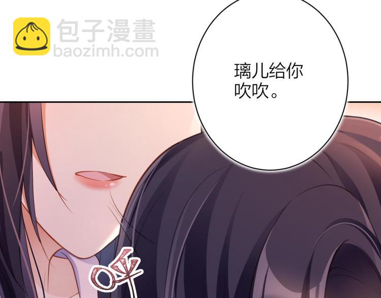 第60话 舅舅，还疼吗？67