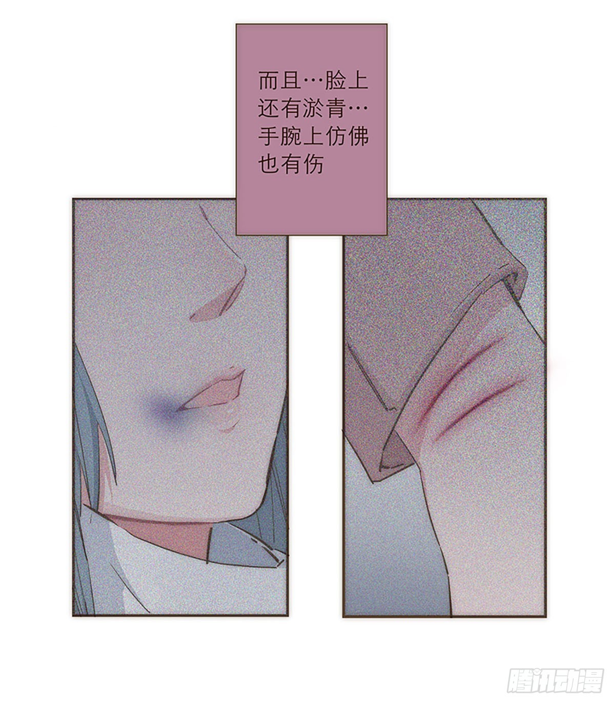 第36话17