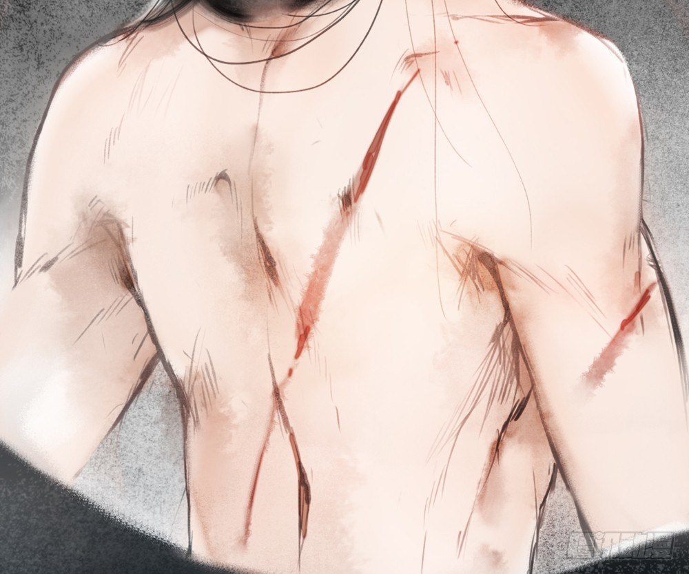 来，帮我上药68