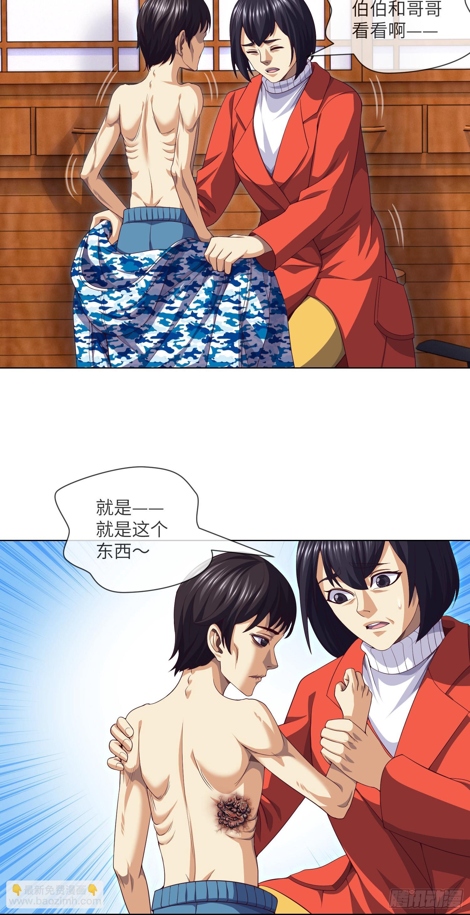 第44话 人面瘤16