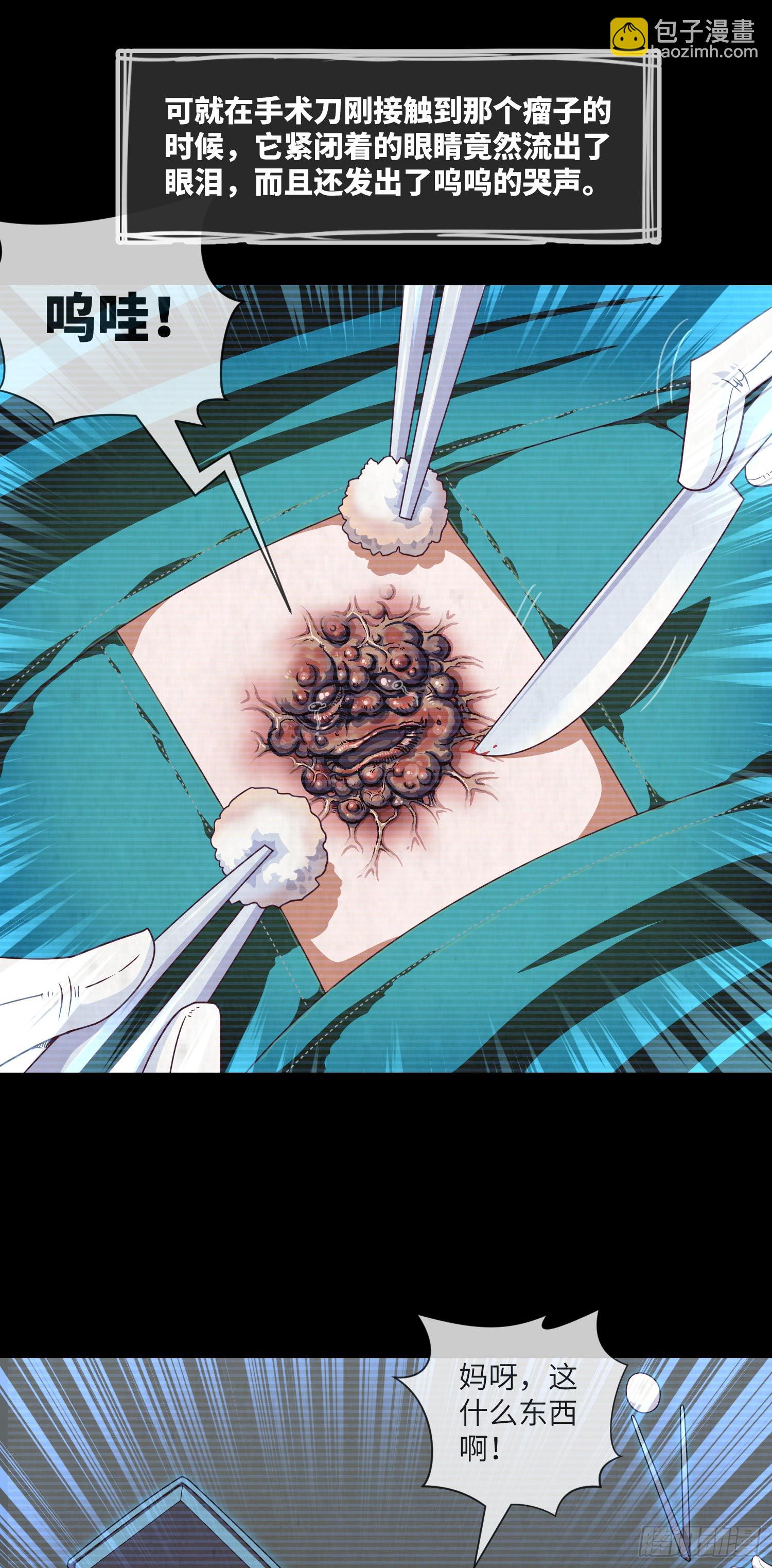 第44话 人面瘤25