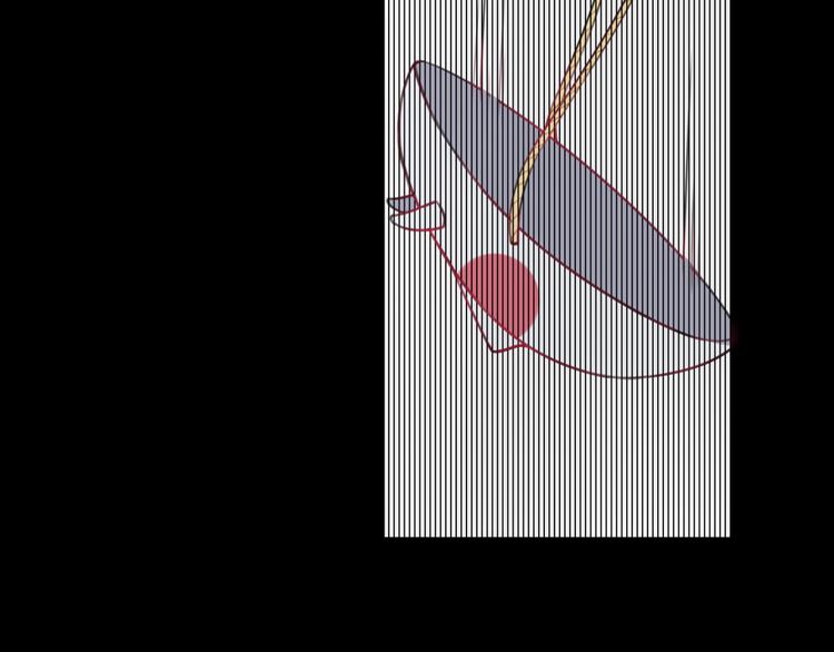第6话 更大的麻烦38