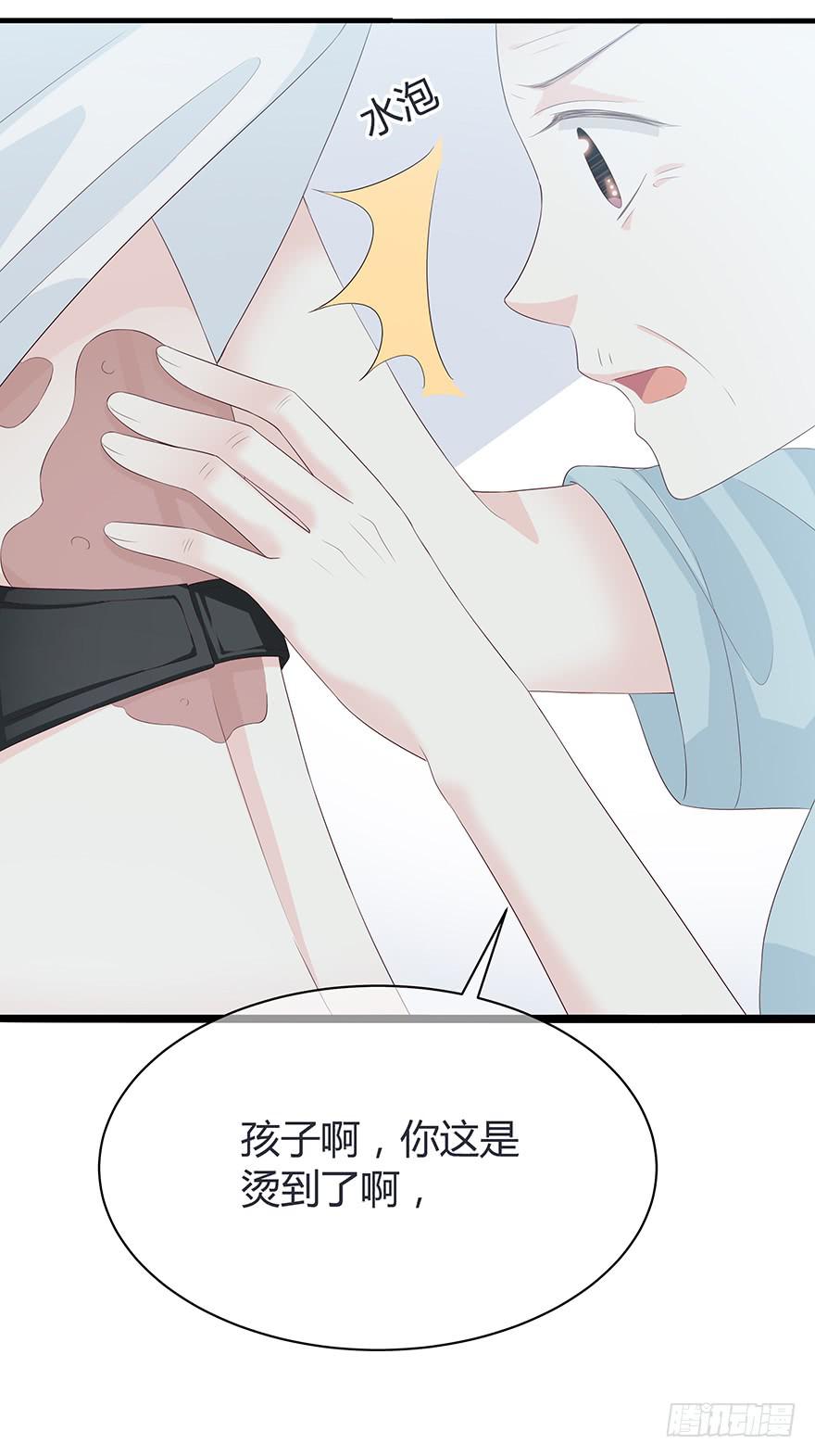 一模一样的烫伤12