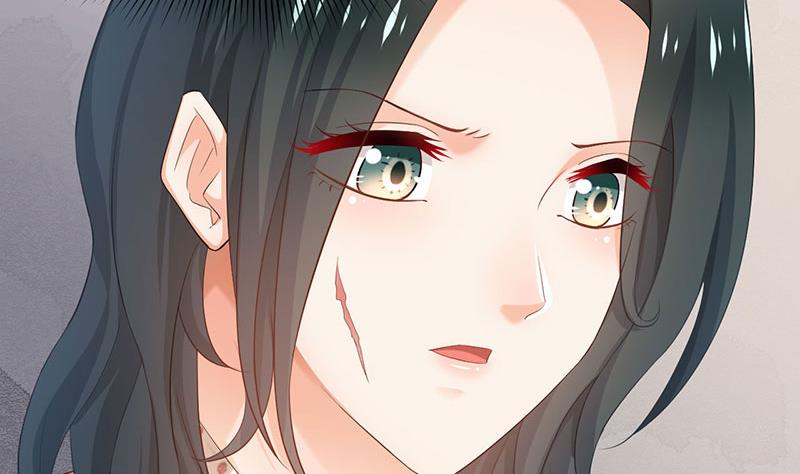 第75话2