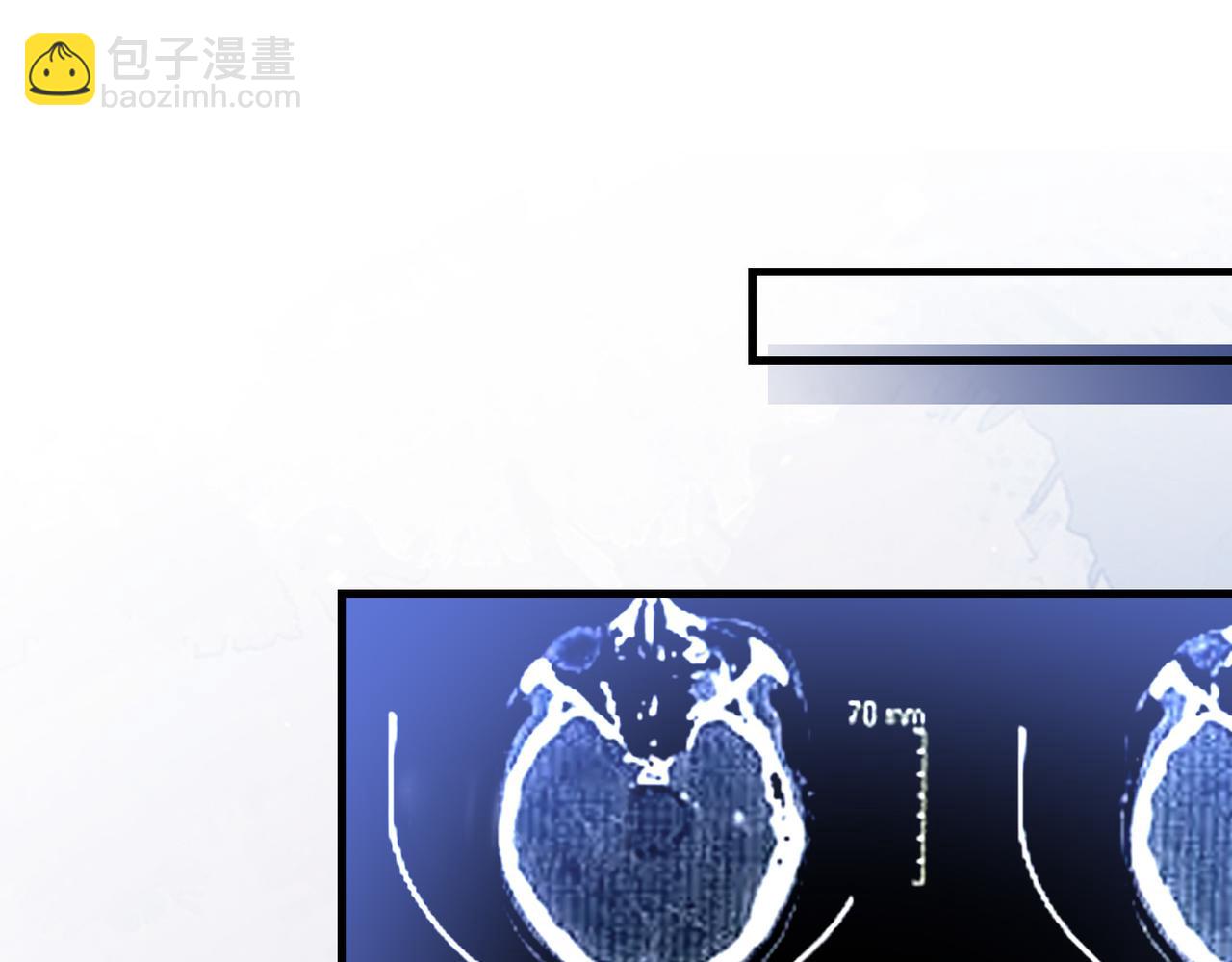 第04话 失忆了？我装的91