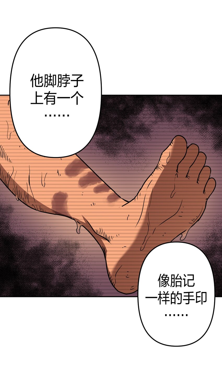 037 神秘的胎记18
